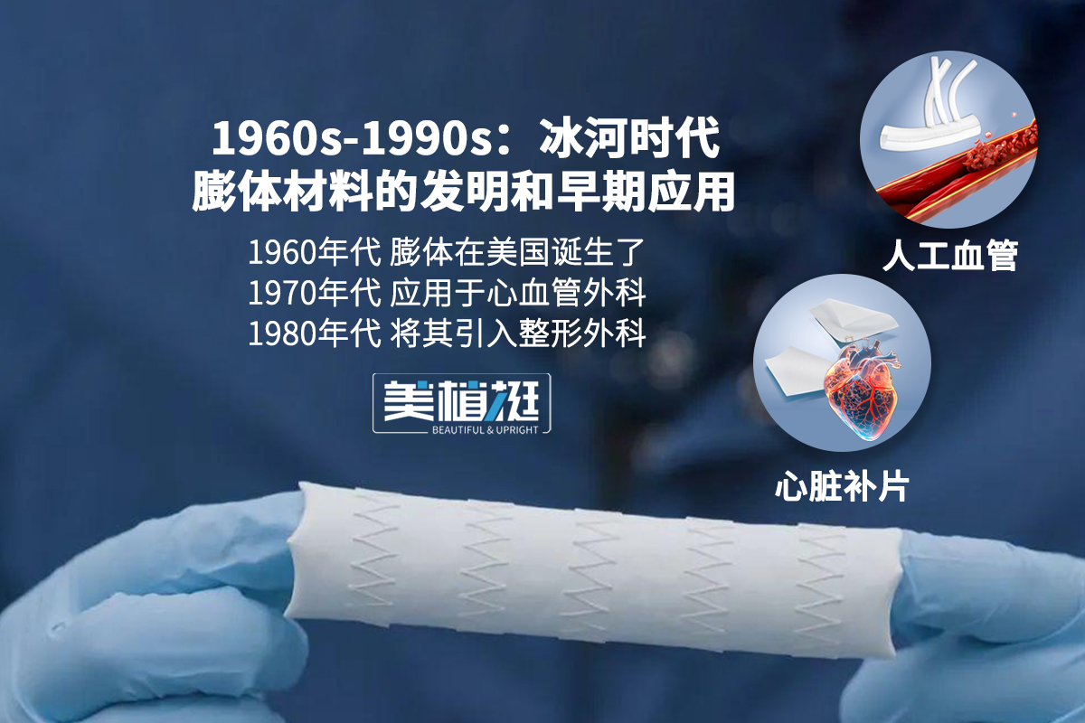 50年进化史：美植挺膨体如何一步步“雕刻”出亚洲人的完美鼻型？